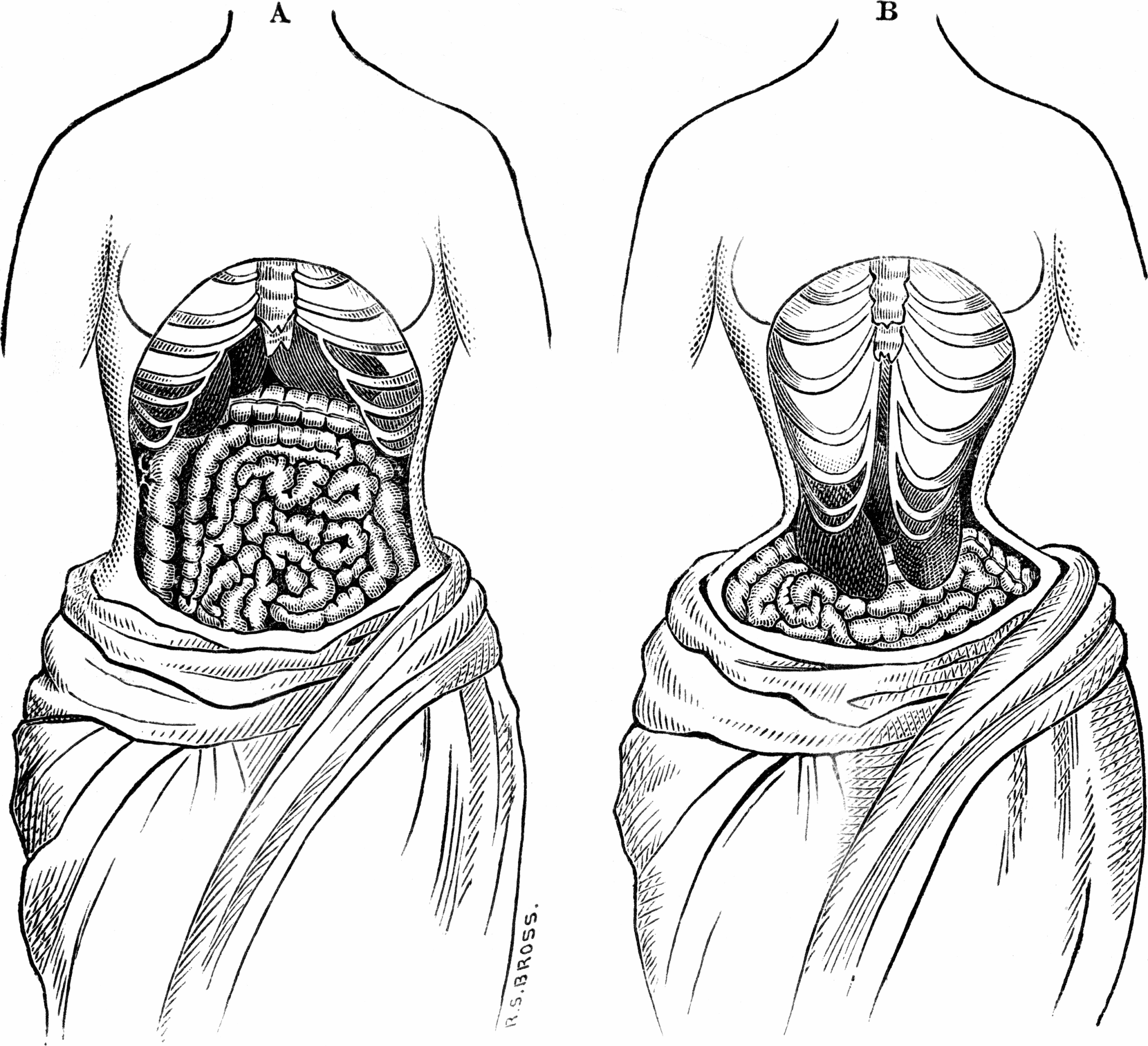 corset organs